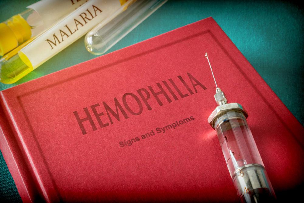 Hemophilia – Its types, causes, symptoms, and management