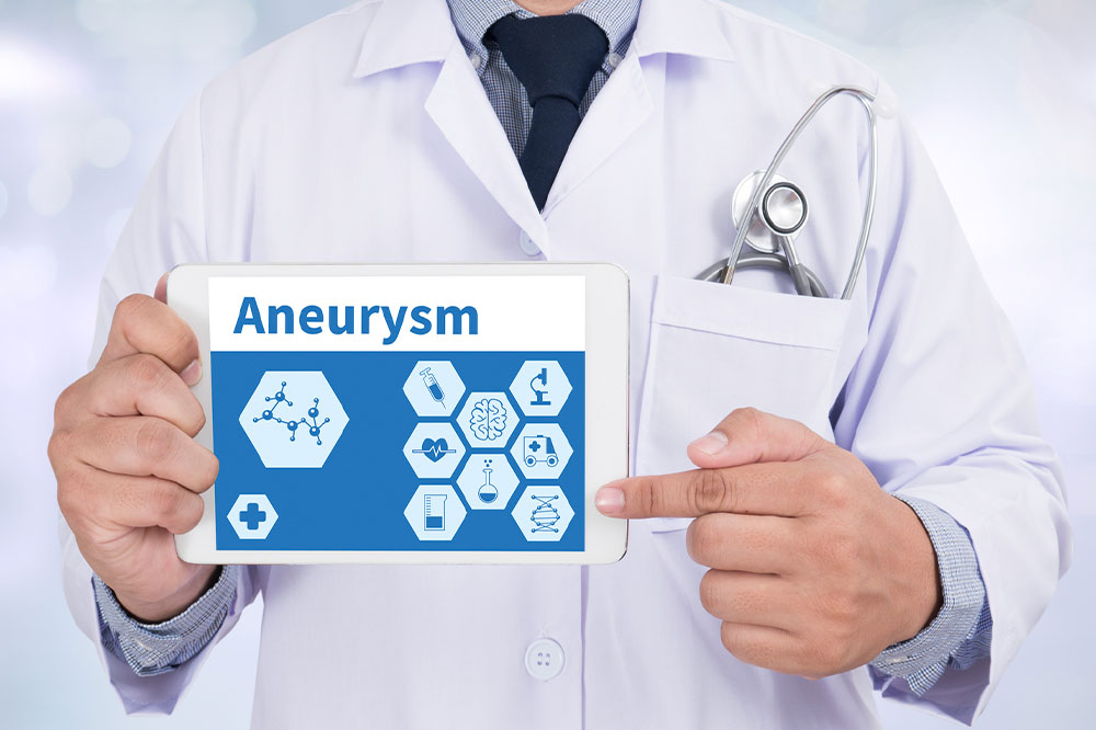 Aneurysms – Causes, symptoms, types, and prevention