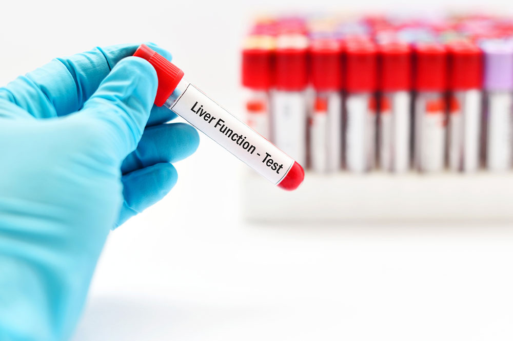 Liver function tests – Types, procedure, and results