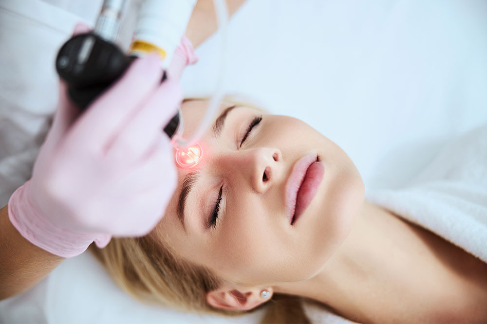 Things to know before undergoing laser resurfacing for acne