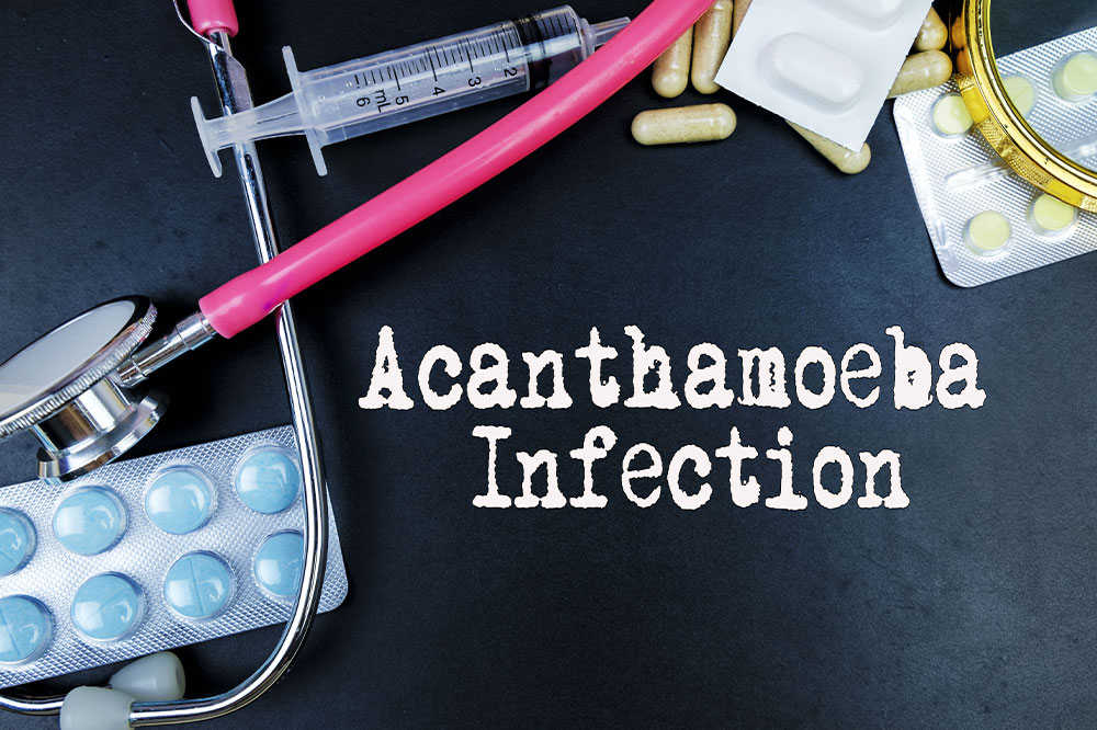 Acanthamoeba infection – Symptoms, causes, and management